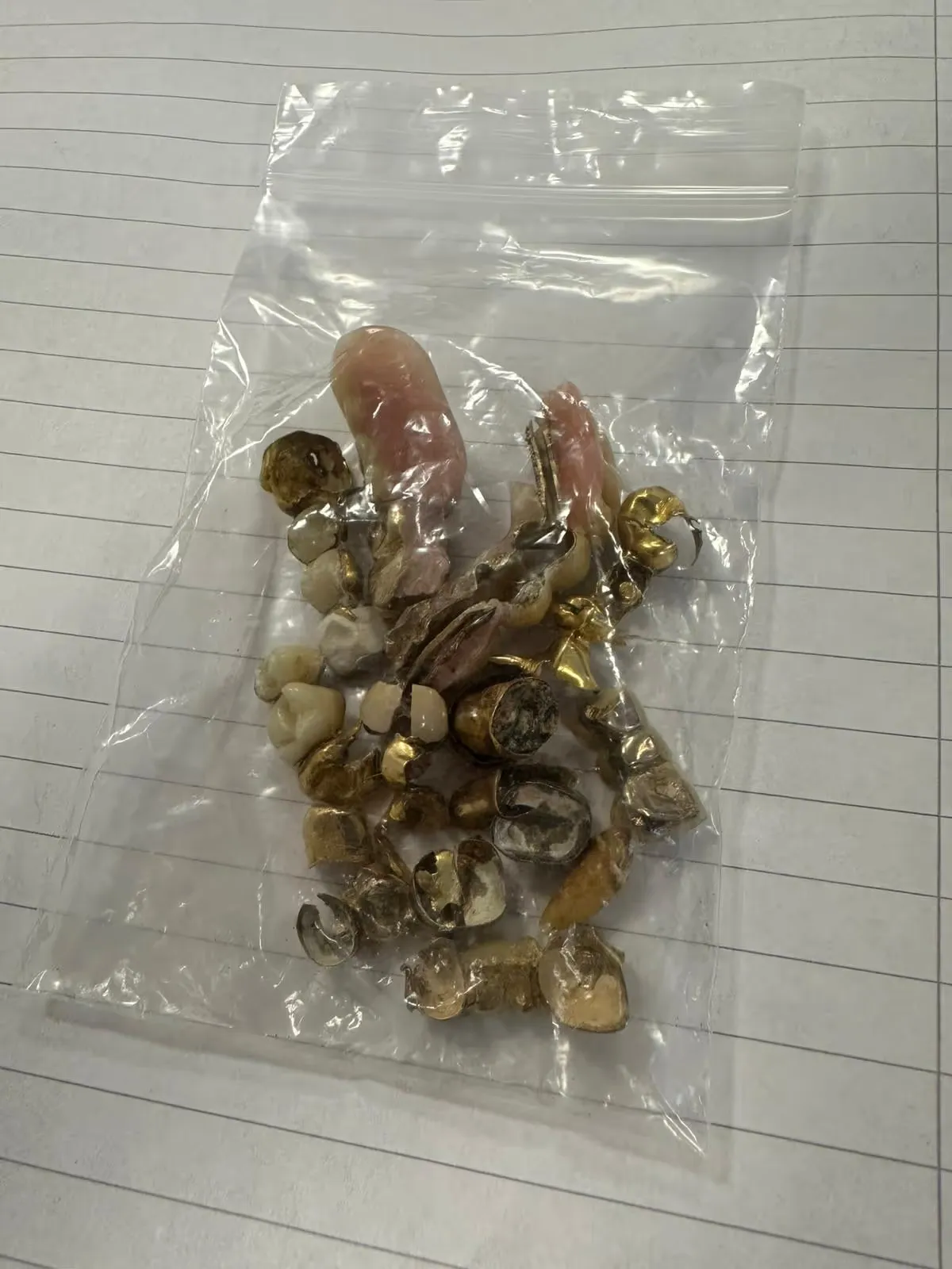 Eingesendetes Zahngold einer Kundin